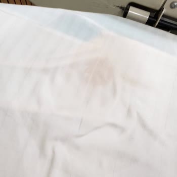 Özel Jimer Hastanesi Jimer Hemşireleri İşi Bilmiyor