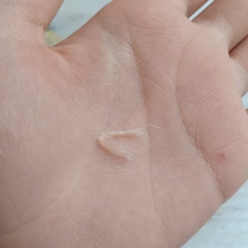 A101 Mısır Ürününün İçinden Çıkan İp Şoku