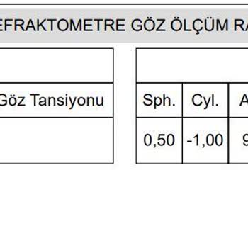 İzmir Hilltown Atasun Optik Yanlış Numaralı Cam Takılması