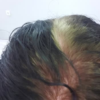 Loreal Paris Saç Boyası Renk Sorunu Ve Koku Problemi