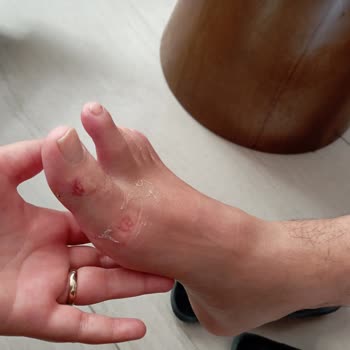 Aydınbey Gold Dreams Türkler