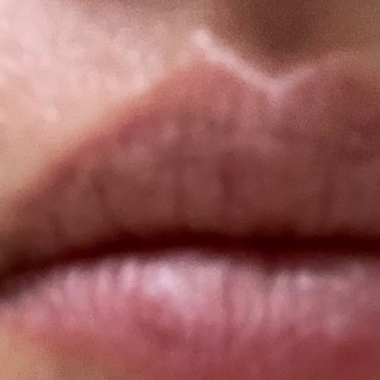 ParkHayat Kütahya Hastanesi Parkhayat Sağlık Grubu ( Kütahya )