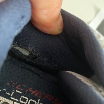 Skechers Ürününde Garanti Sorunu Ve Kullanıcı Hatası İddiası