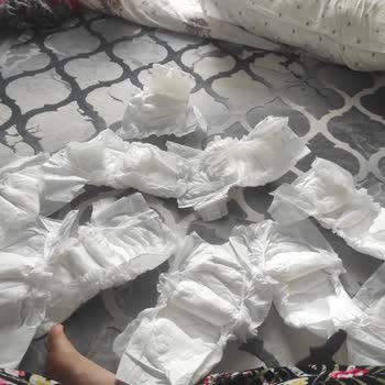 Baby Turco Bezlerin Cırtları Yok