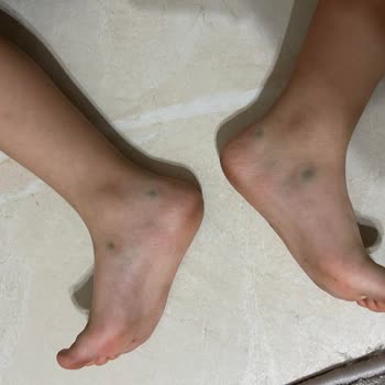 Ayakkabı Dünyası Ayakkabının Rengi Çocuğun Ayağına Çıkıyor Ama Sorun Yok Deniyor