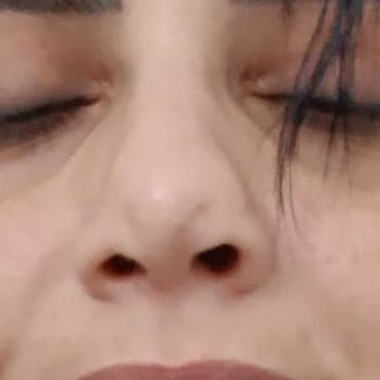 Op. Dr Uğur Recep Çelik Burnumu Mahvetti!