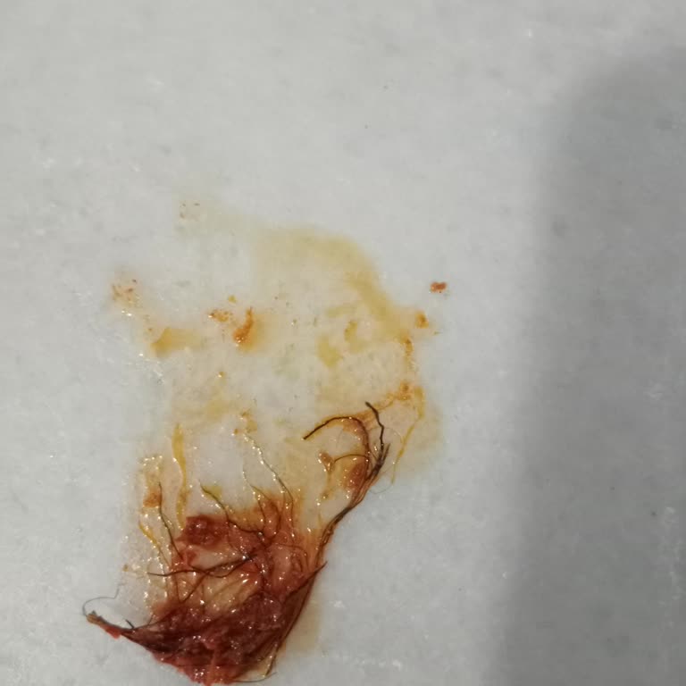 Özkaleli Salçanın İçinden Çıkan İp Yumağı