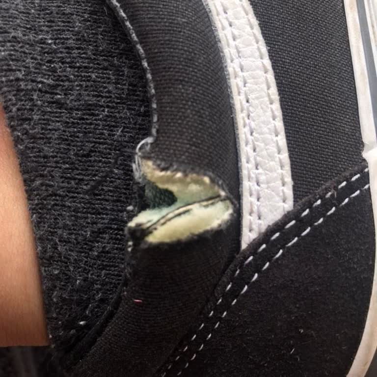 Koray Spor Vans Ayakkabı Bilek Yırtığı Şikayeti