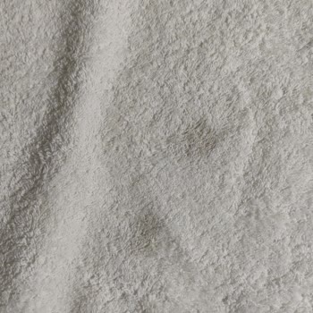 Pas Lekesi Sorunu ve Umursamaz Servis Hizmeti