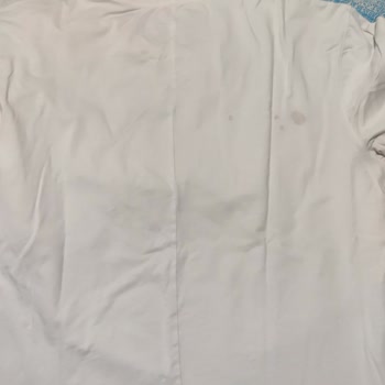 Pas Lekesi Sorunu ve Umursamaz Servis Hizmeti