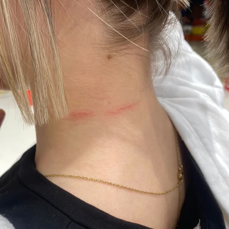 Salon Diva Uğur Saç Kesiminde Yaşanan Talihsiz Kaza Ve Yetersiz Hizmet