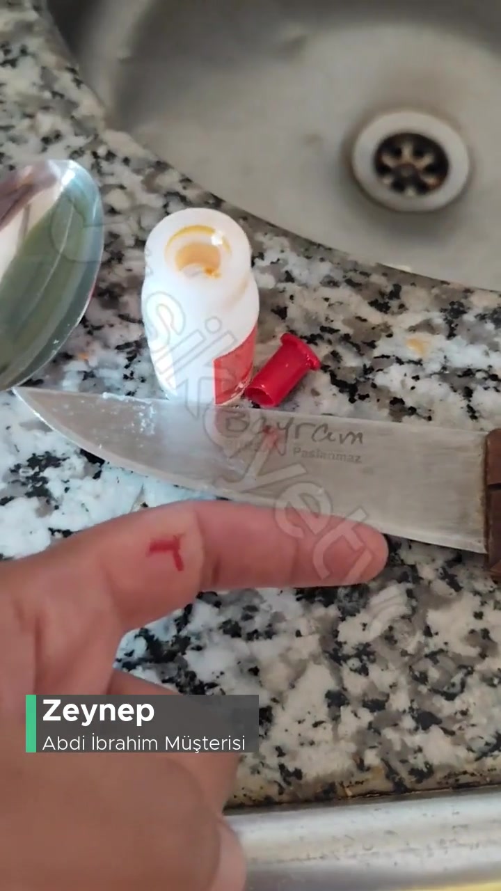 Abdi İbrahim Kapak Açma Sorunu! videonun kapak resmi