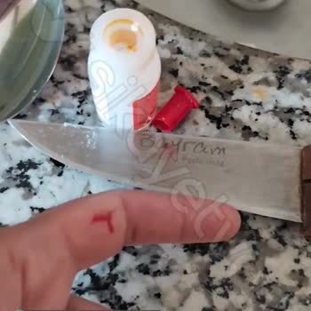 Abdi İbrahim Kapak Açma Sorunu!