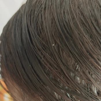 Dalin Bebek Şampuanı Kepek Yaptı