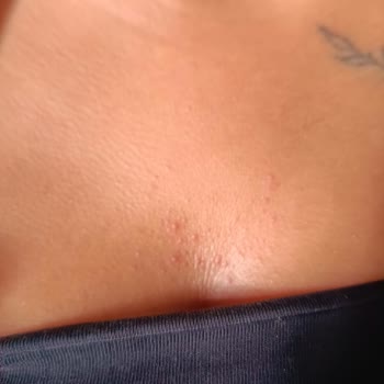 Shesra Firması Ürün Şikayeti