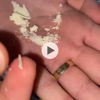 Hipp Bebek Mamasında Yabancı Cisim Bulundu