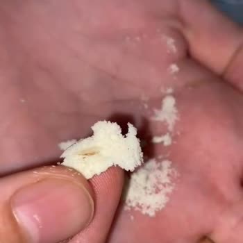 Hipp Bebek Mamasında Yabancı Cisim Bulundu