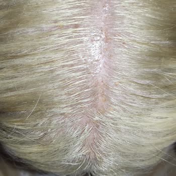 Miss Coiffeur Tekirdağ Merkez Kuaför Deneyimi