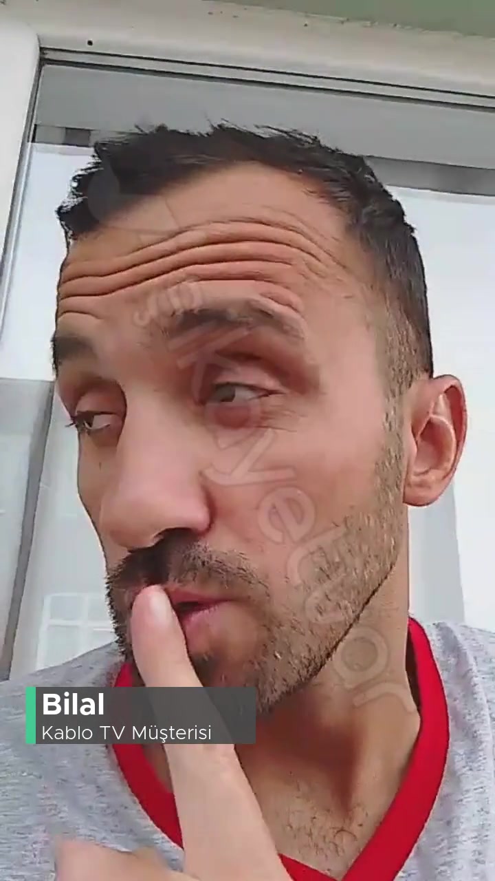 Kablo TV Donma Ve Kasma Sorunu videonun kapak resmi