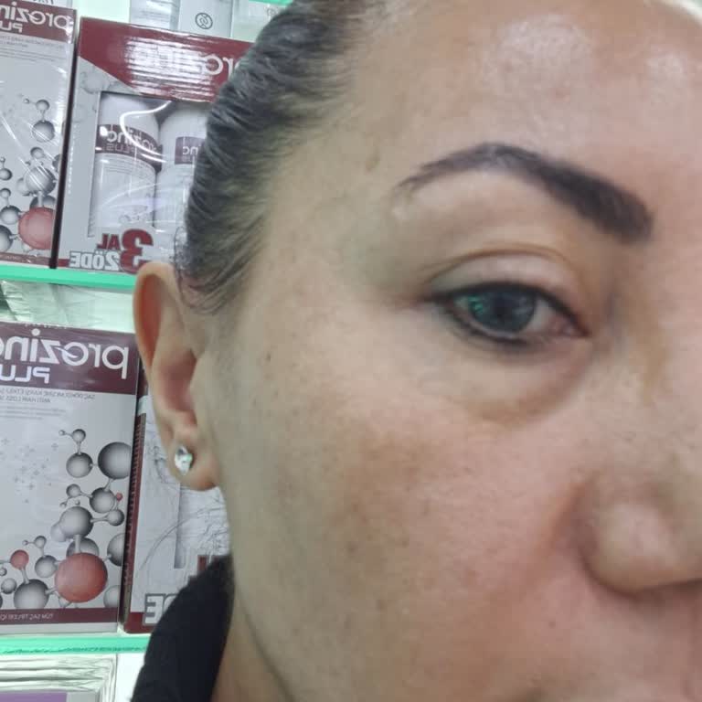 Muse Beauty Memnuniyetsizliği