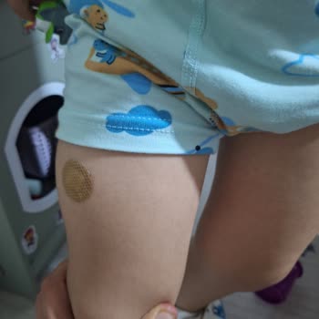 Özel Ümit Hastanesi Acil Serviste Yaşanan Olumsuz Deneyim Ve İğne Uygulaması Sorunu