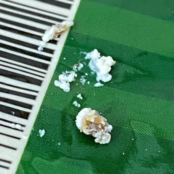 Peynes Peynir Lor Peynirden Çıkan Yabancı Cisim