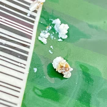 Peynes Peynir Lor Peynirden Çıkan Yabancı Cisim