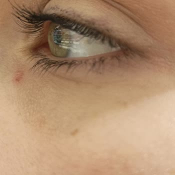 Yves Rocher Ürün Şikayet Hk,