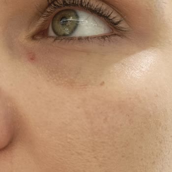 Yves Rocher Ürün Şikayet Hk,