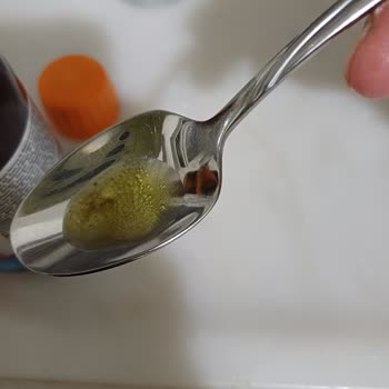 Argivit Patladı Ve Çok Asitli İçinden Siyah Bir Şey Çıkıyor