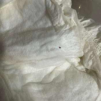 Sleepy Bebek Bezinde Böcekler