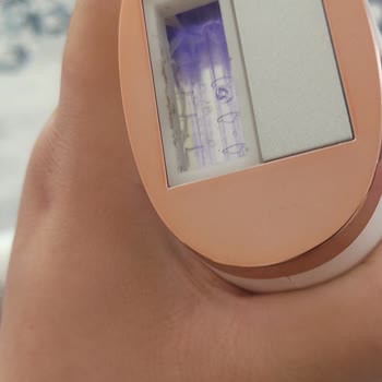 Riomi Buz Lazer Pişmanlığı