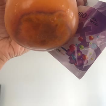 Acvison Bozuk Ürünler Tedavimi Yarıda Bıraktı