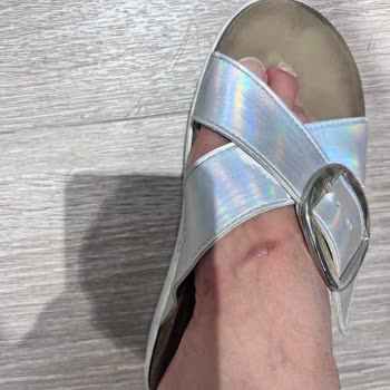 Deichmann Kalite Sorunu Ve Ürünün Arkasında Durmama