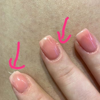 Pronail Hijyen Ve Kalite Sorunlarıyla Karşılaştım