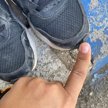 Deichmann Ayakkabı Sayılı Giyilmesine Rağmen Önü Kalktı Cırt Cırtları Tutmuyor