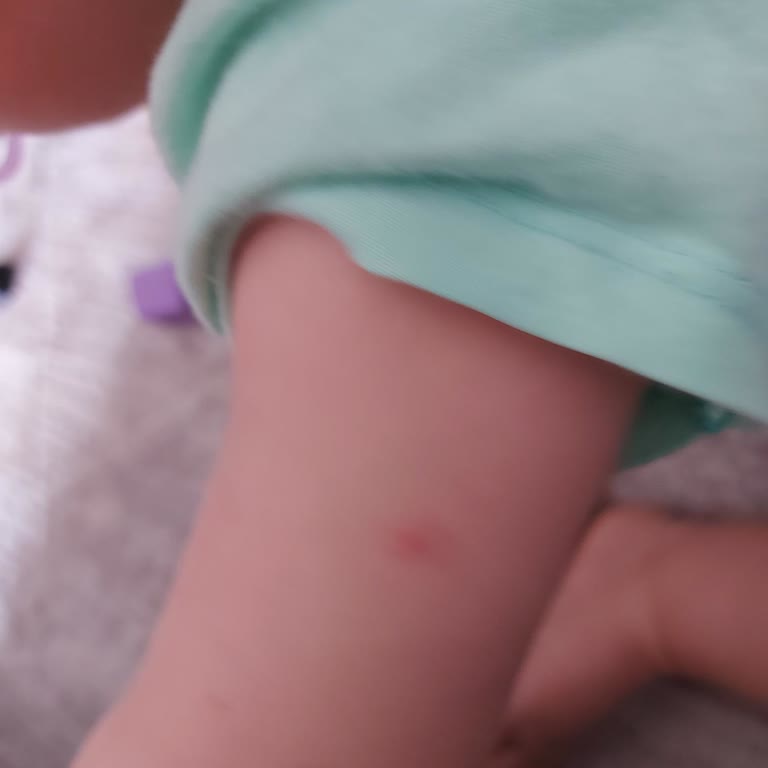 Raid Mosquito Repellent Fails to Work: My Baby Wakes Up with Bites Every Morning