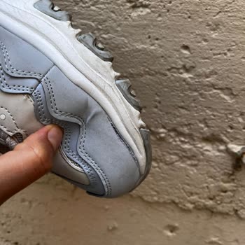 Skechers Hayal Kırıklığın Mağduriyete Dönüşmesi