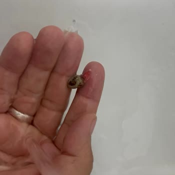 Çitlekçi'den Çıkan Taşlı Lokum Hk.