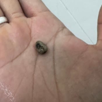 Çitlekçi'den Çıkan Taşlı Lokum Hk.