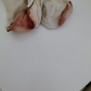 Hummel Marka Ayakkabının Ayak Parçalaması