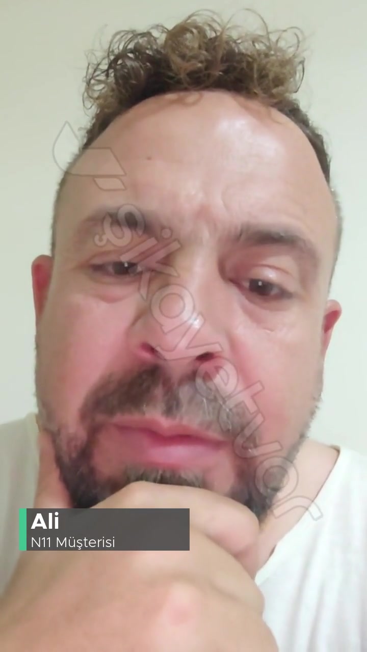 N11 Kişisel Verilerinizi Paylaşıyor! videonun kapak resmi