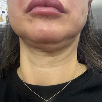 Nez Demir Ümraniye Şube Müşterisini Ortada Bırakıyor.