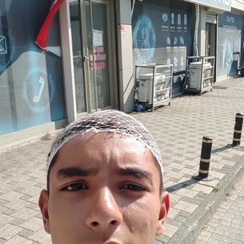 Onvo Ov-12x Plus Gidon Kırılması