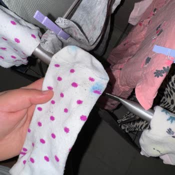 Crocs Terlik & Ayakkabı Terliklerin Boya Sorunu Ve Kalite Problemi