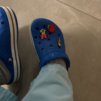Crocs Terlik & Ayakkabı Terliklerin Boya Sorunu Ve Kalite Problemi