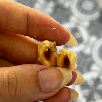 Migros Şenocak Gıda Böcekli Fındık Satması
