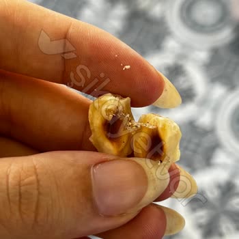 Şenocak Gıda Böcekli Fındık Satması