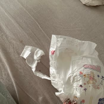 Goon Bebek Bezinin Cırtlardan Yırtılması