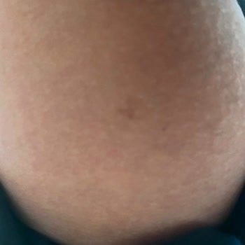 Aris Güzellik Merkezleri Güzellik Merkezinde Mobbing Ve Yanık Şikayeti